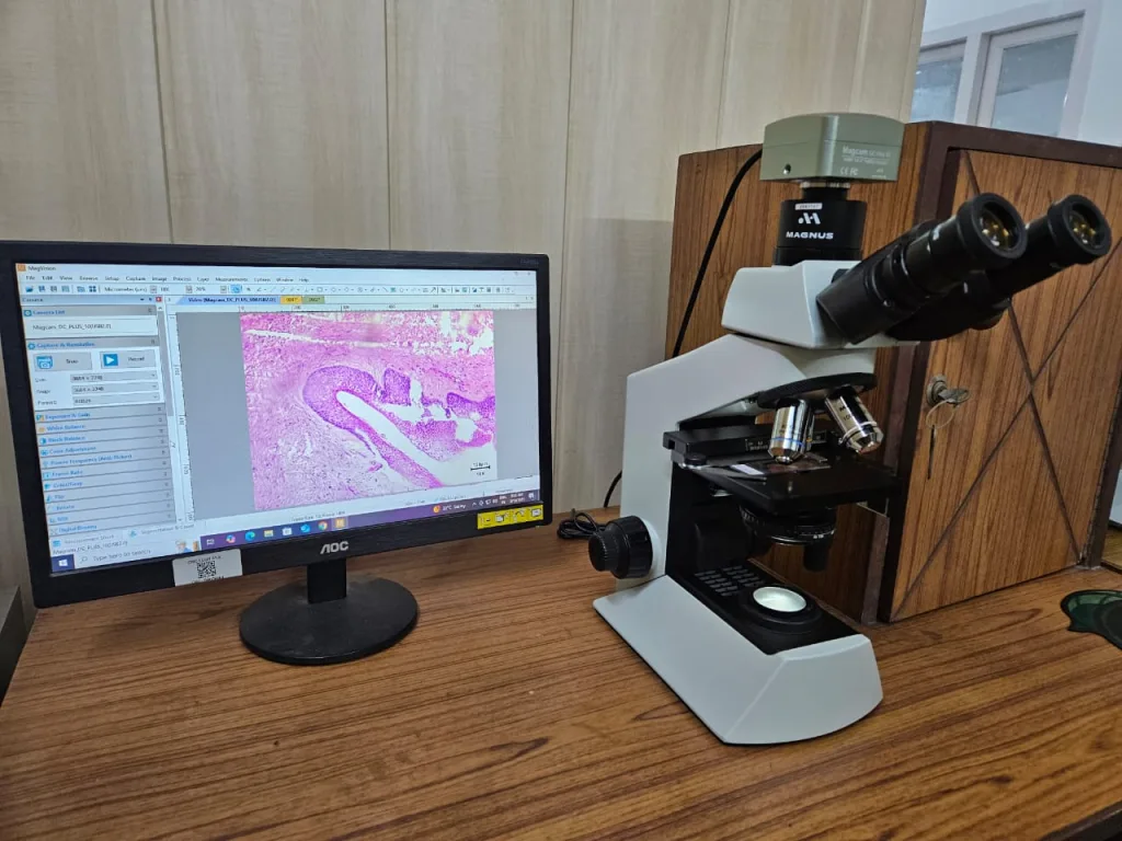A computer monitor displays a magnified pink and purple tissue sample image next to a binocular microscope on a wooden desk in a laboratory setting.